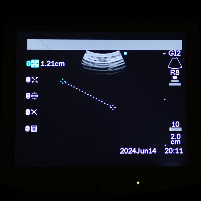 Olympus EVIS BF-UC160F-0L8 Ultrasonic Bronchoscope with EU-C60 Ultrasound Center